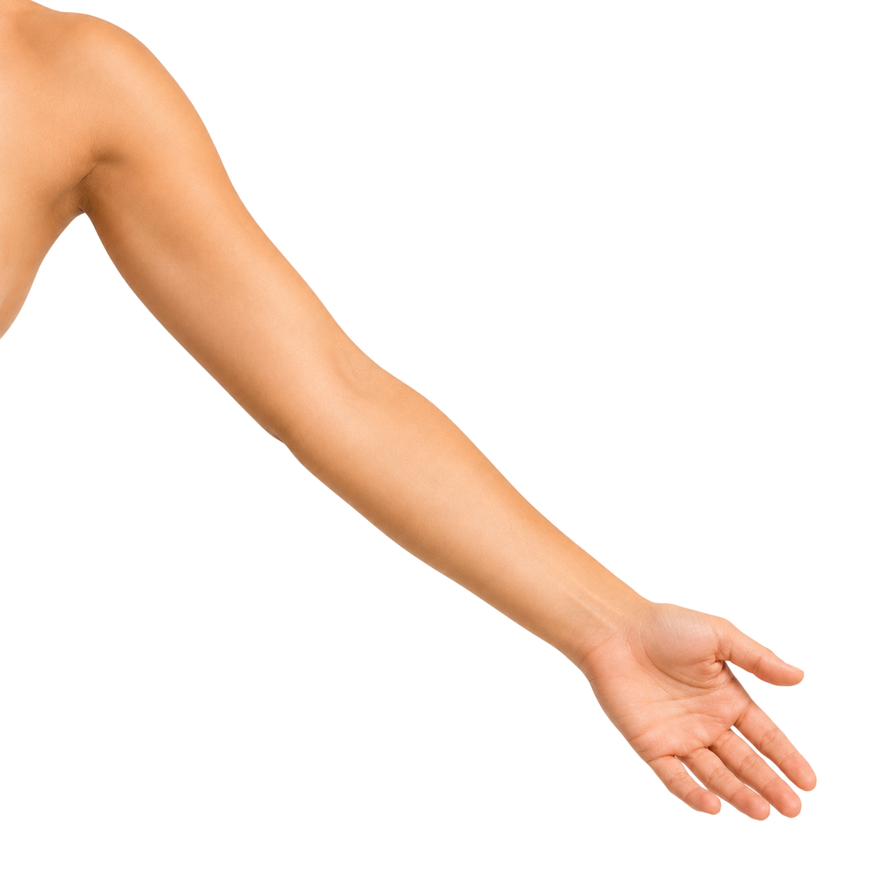 arm